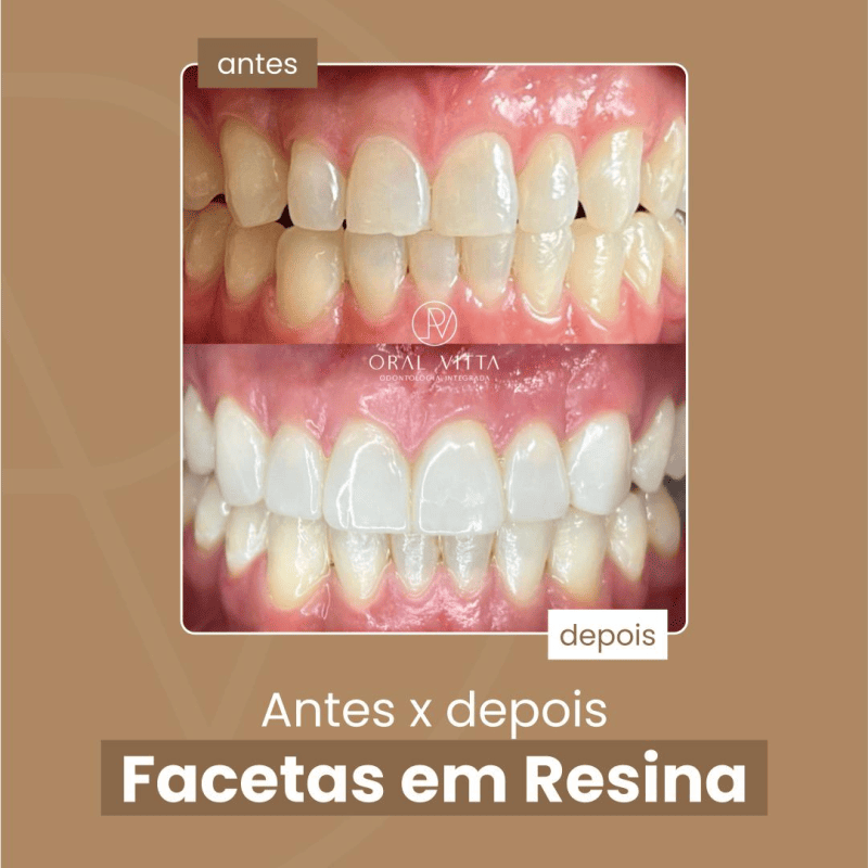 oral 2