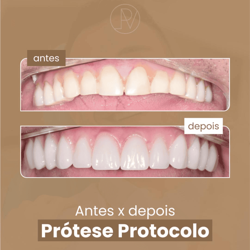 oral 3