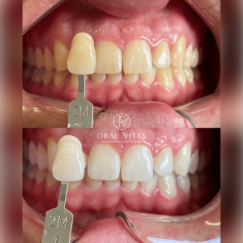 oral 4