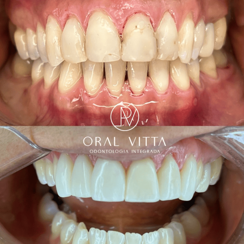 oral 5