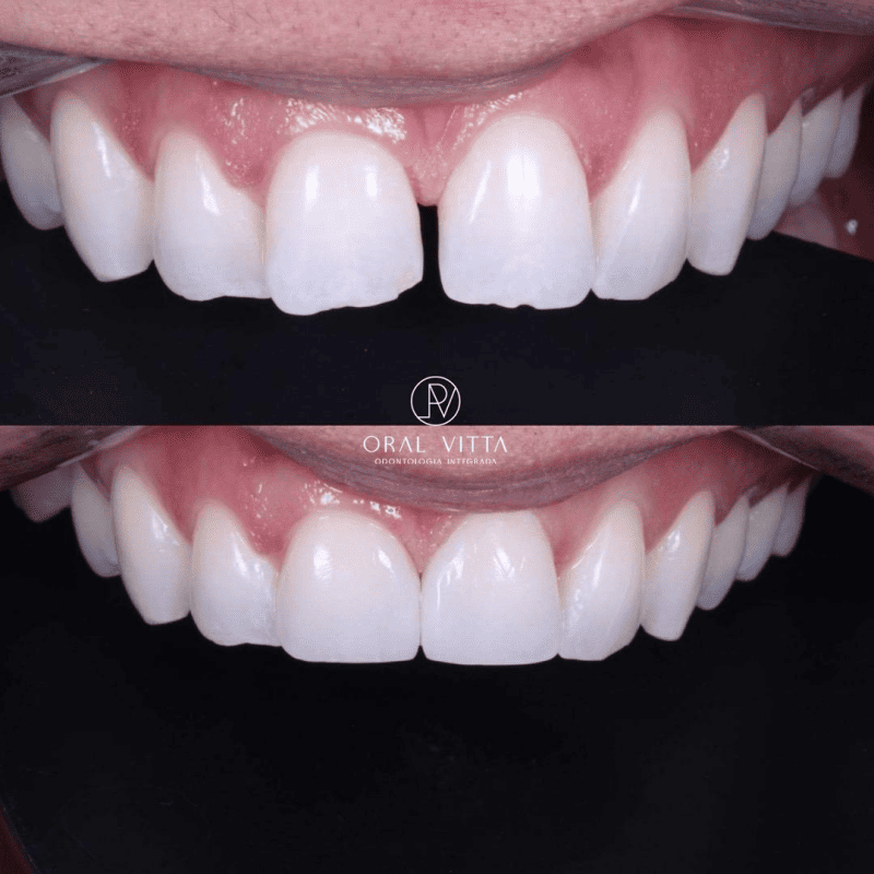oral.